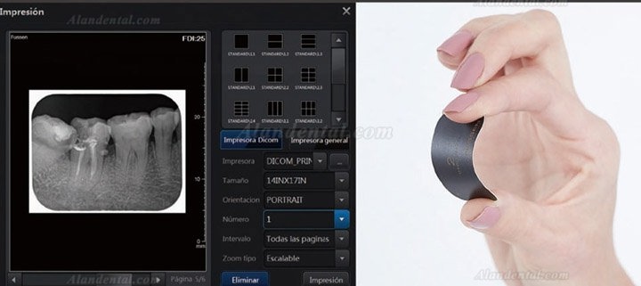 Fussen F200 Dental Phosphor Plate Scanner PSP X ray Scanner